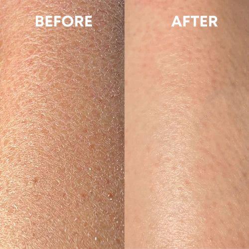 2 pcs Hand & Nail Therapy