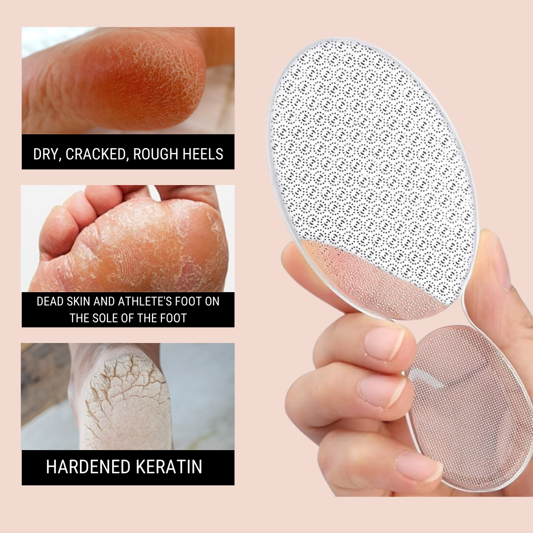 Complete Foot Care Bundle – Goodbye Dry Heels & Calluses