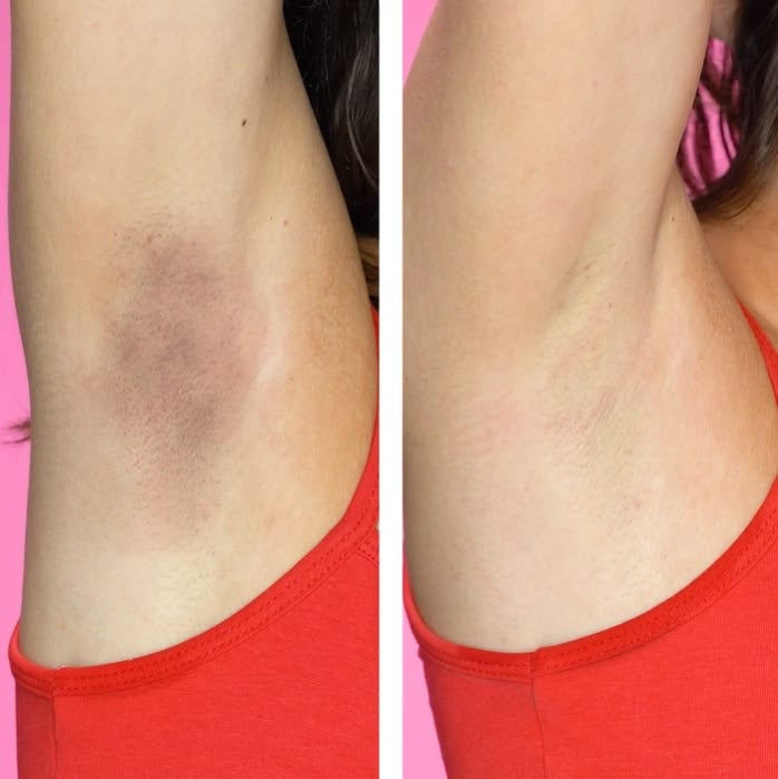 Lumi Care - Brightening Serum