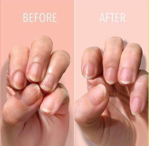 2 pcs Hand & Nail Therapy