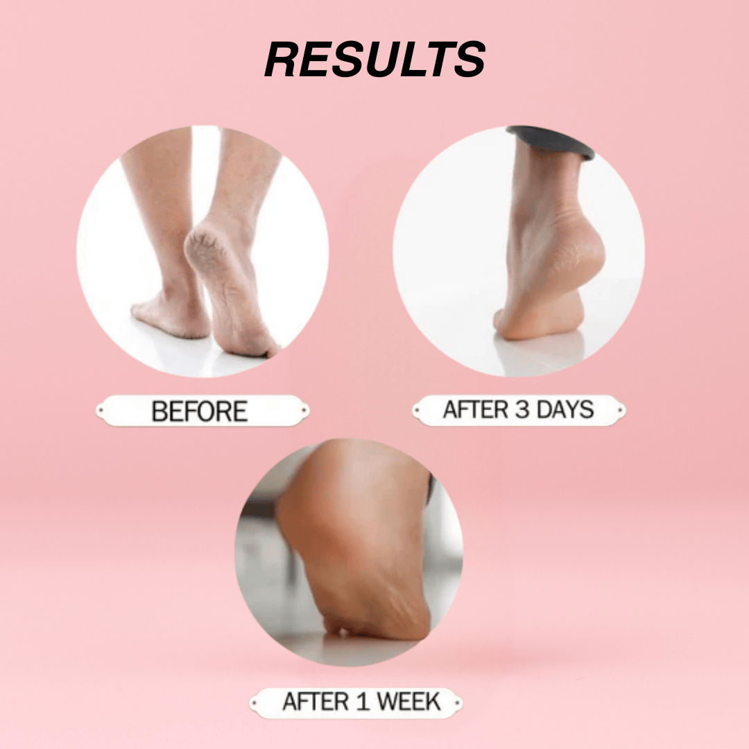 2pcs Overnight Treatment