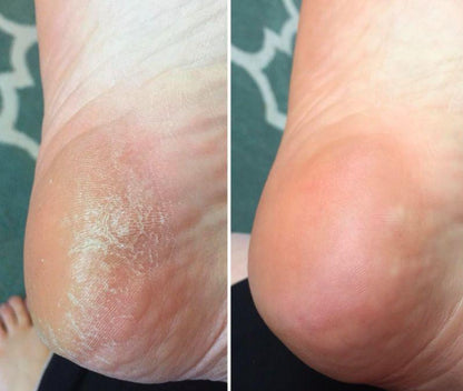 4pcs Essential Foot Care- Balm, Cream, Socks &amp; Nanoglow File