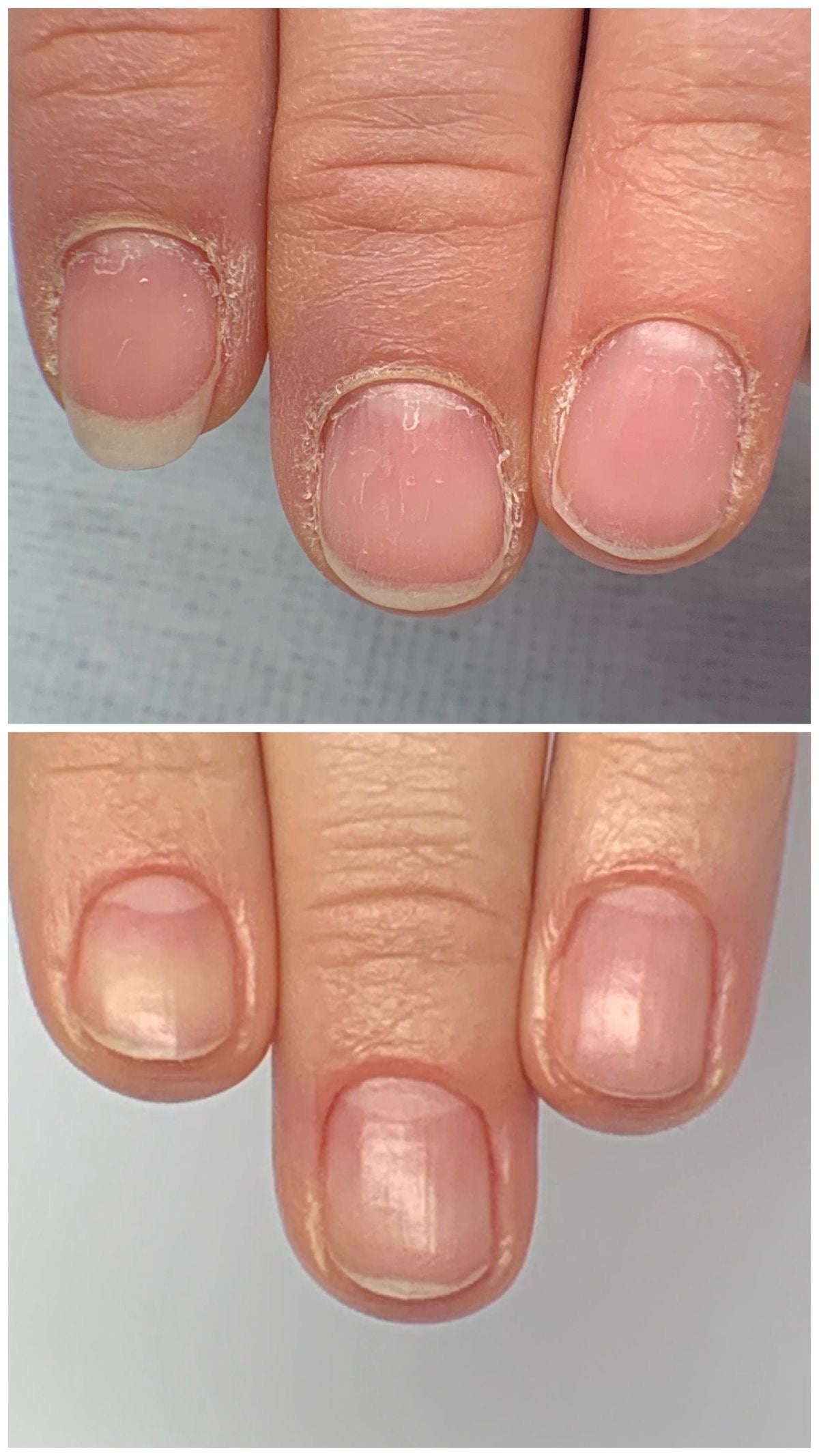 Nail &amp; Cuticle Oil Therapy