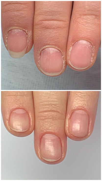Nail &amp; Cuticle Oil Therapy