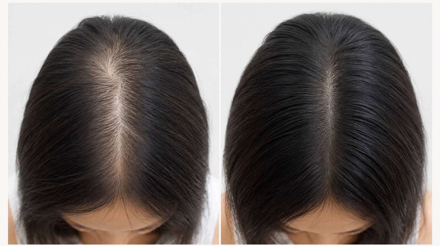 InGlow Rosemary &amp; Blackseed Hair Growth Oil
