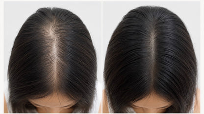 InGlow Rosemary &amp; Blackseed Hair Growth Oil