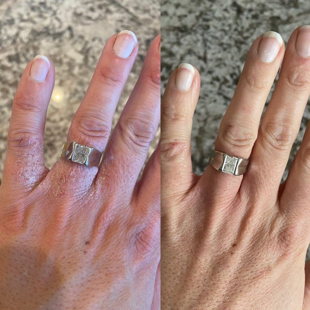 2 pcs Hand &amp; Nail Therapy