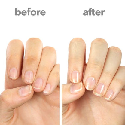 Nail &amp; Cuticle Oil Therapy