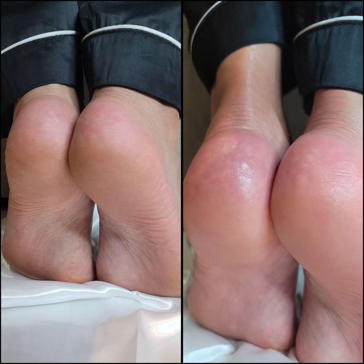 4pcs Essential Foot Care- Balm, Cream, Socks &amp; Nanoglow File