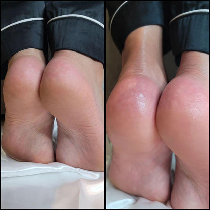 4pcs Essential Foot Care- Balm, Cream, Socks &amp; Nanoglow File