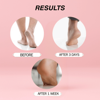 2pcs Overnight Treatment